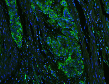Anti-HLA-C Antibody