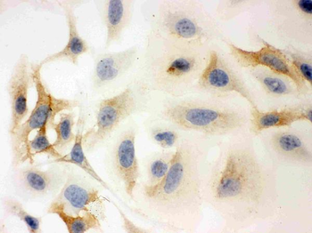 Anti-HLA-C Antibody