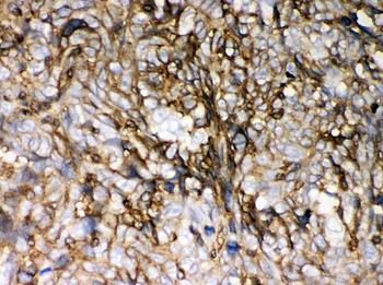 Anti-HLA-C Antibody