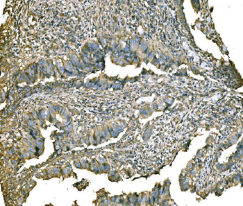 Anti-PKM2 Antibody
