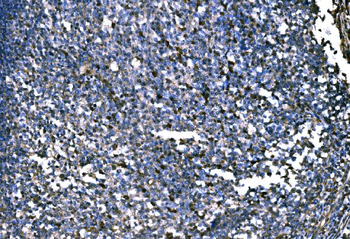 Anti-PKM2 Antibody