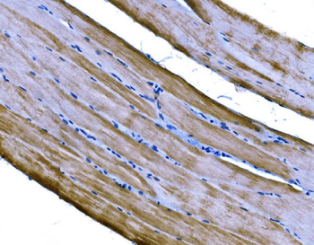 Anti-PKM2 Antibody
