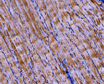 Anti-PKM2 Antibody