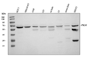 Anti-PKM2 Antibody
