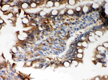 Anti-Peroxiredoxin 5/PRDX5 Antibody