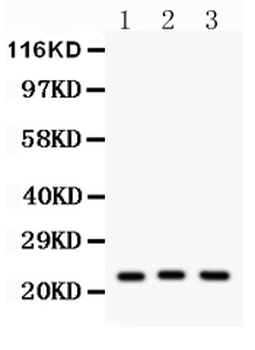 Anti-Peroxiredoxin 5/PRDX5 Antibody