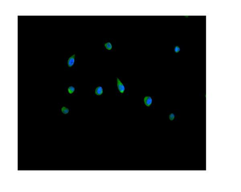 Anti-Peroxiredoxin 5/PRDX5 Antibody