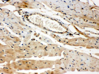 Anti-ROCK2 Antibody