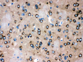Anti-ROCK2 Antibody
