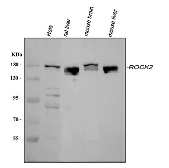 Anti-ROCK2 Antibody