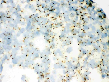 Anti-SFTPA1/2 Antibody