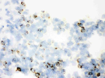 Anti-SFTPA1/2 Antibody