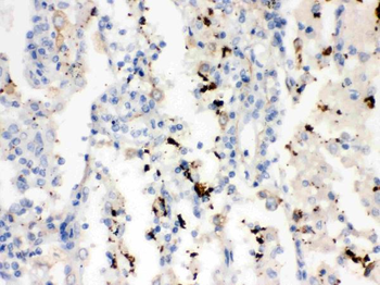 Anti-SFTPA1/2 Antibody