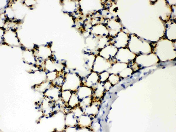 Anti-SFTPA1/2 Antibody