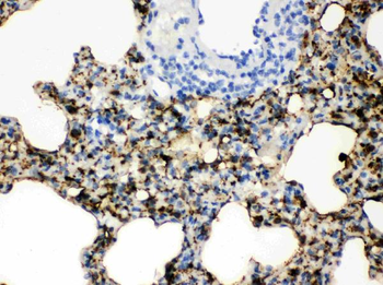 Anti-SFTPA1/2 Antibody