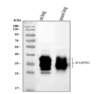 Anti-SFTPA1/2 Antibody