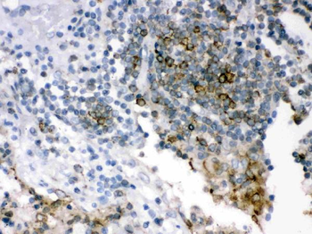 Anti-SHC/SHC1 Antibody