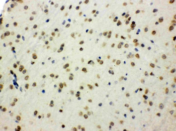 Anti-SHC/SHC1 Antibody
