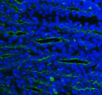 Anti-SLC12A1 Antibody