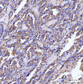 Anti-SLC12A1 Antibody