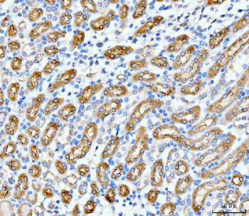 Anti-SLC12A1 Antibody