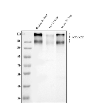 Anti-SLC12A1 Antibody