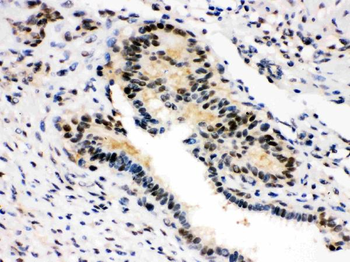 Anti-SMN1/2 Antibody