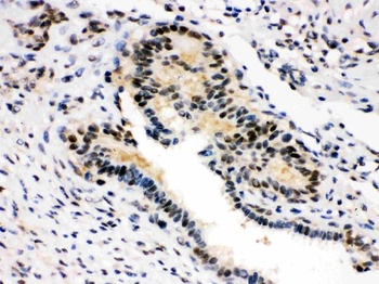 SMN1/2 Antibody