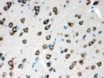 Anti-SMN1/2 Antibody