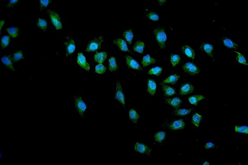 Anti-SMN1/2 Antibody