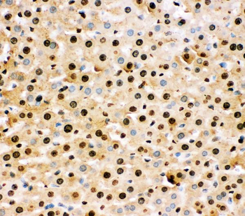 Anti-Superoxide Dismutase 1/SOD1 Antibody