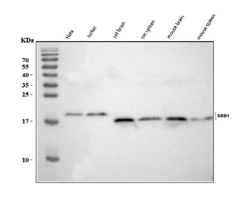 Anti-Superoxide Dismutase 1/SOD1 Antibody