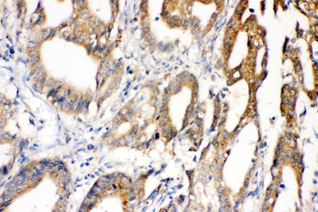 Anti-Superoxide Dismutase 1/SOD1 Antibody