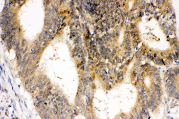 Anti-Superoxide Dismutase 1/SOD1 Antibody