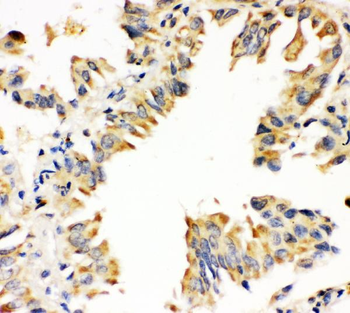 Anti-Superoxide Dismutase 1/SOD1 Antibody