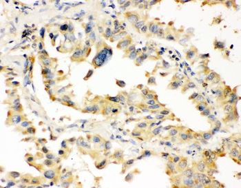 Anti-Superoxide Dismutase 1/SOD1 Antibody