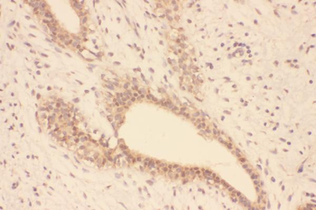 Anti-Superoxide Dismutase 1/SOD1 Antibody