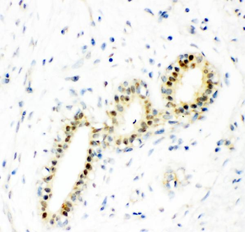 Anti-Superoxide Dismutase 1/SOD1 Antibody