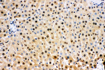 Anti-Superoxide Dismutase 1/SOD1 Antibody