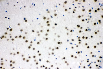 Anti-SF2/SRSF1 Antibody