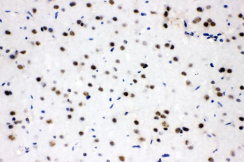 Anti-SF2/SRSF1 Antibody