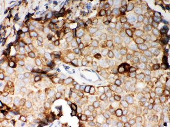 Anti-STIM1 Antibody