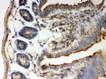 Anti-STIM1 Antibody