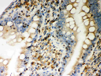 Anti-STIM1 Antibody