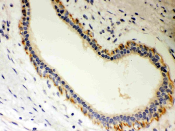 Unrip/STRAP Rabbit Polyclonal Antibody