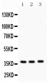 Syntaxin 1a/STX1A Rabbit Polyclonal Antibody