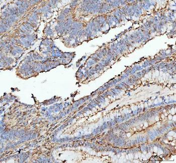 Anti-Actin/ACTA1 Antibody