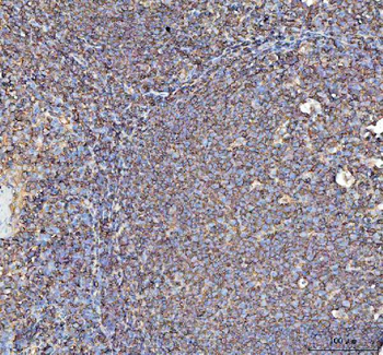 Anti-Actin/ACTA1 Antibody