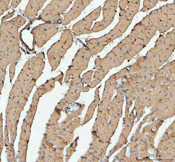 Anti-Actin/ACTA1 Antibody