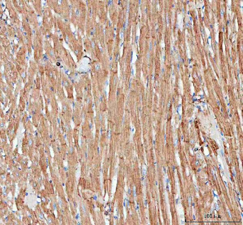 Anti-Actin/ACTA1 Antibody